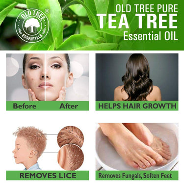 Old Tree Pure & Natural Tea Tree Essential Oil (15ml) - for Skin, Diffusers, Hair, Body, Acne, Nail care - Undiluted Essential Oil with Dropper for Aroma Therapy and Stress Relief
